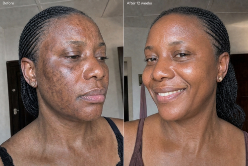 Melova Repair Serum