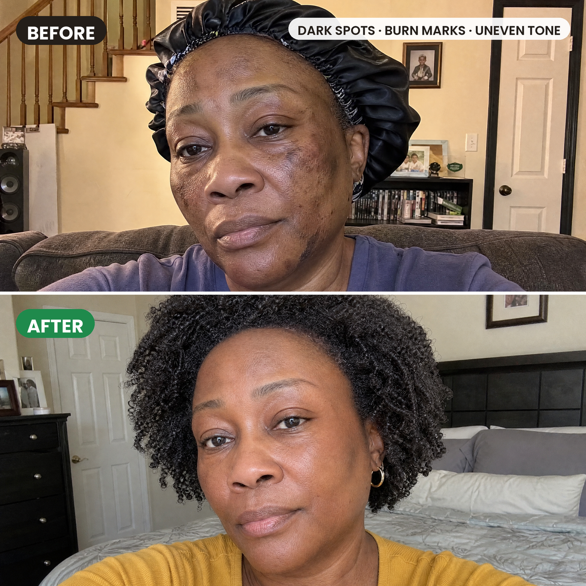 Face comparison