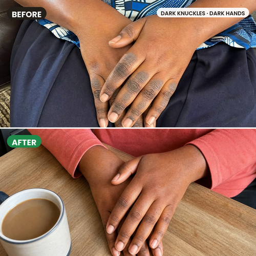 Hands comparison